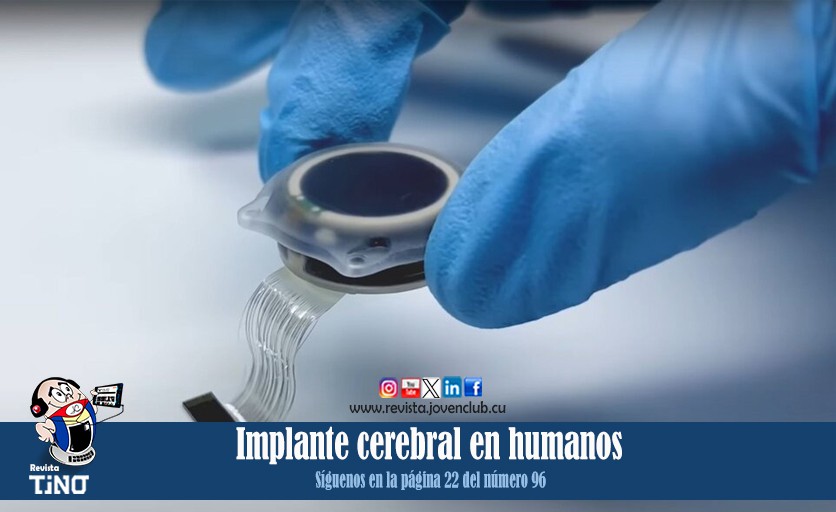 Implante cerebral en humanos